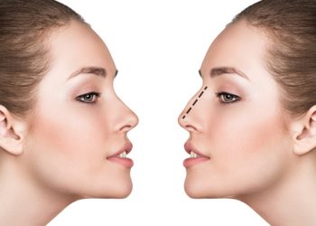 5 Common Reasons for Women to Request Nose Augmentation Surgery