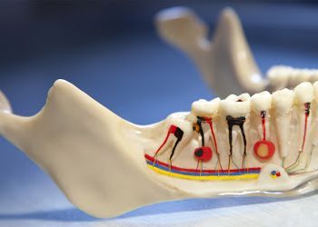 What can I do if I’ve suffered from a failed root canal?