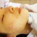 Factors to consider while choosing a skin clinic