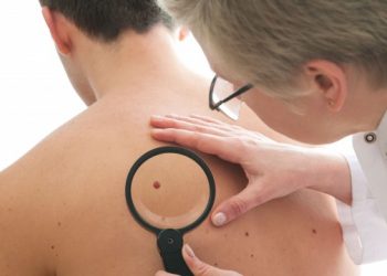 How a Skin Cancer Doctor Examines Suspicious Moles