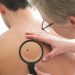 How a Skin Cancer Doctor Examines Suspicious Moles