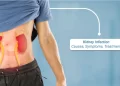 Understanding Telehealth For Kidney Infection: Benefits, Tips, And Best Practices