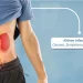 Understanding Telehealth For Kidney Infection: Benefits, Tips, And Best Practices